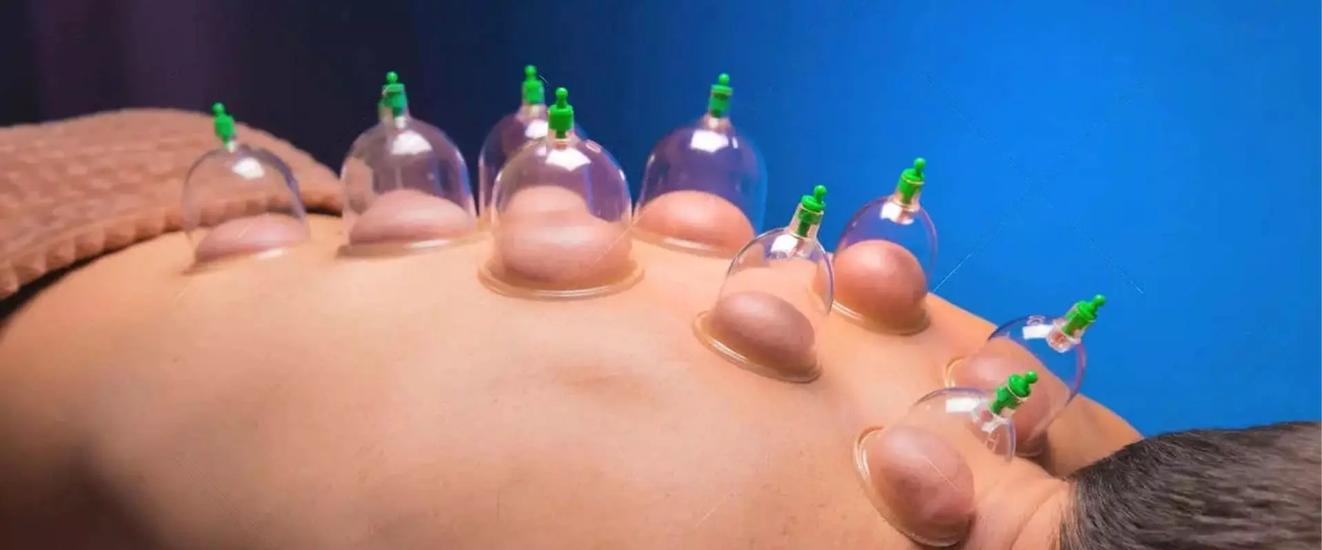 Méthode Hijama